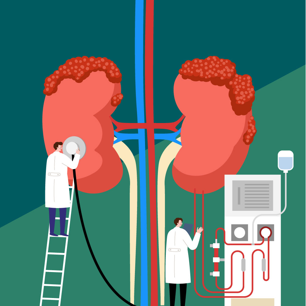 혈액투석이란 무엇일까?