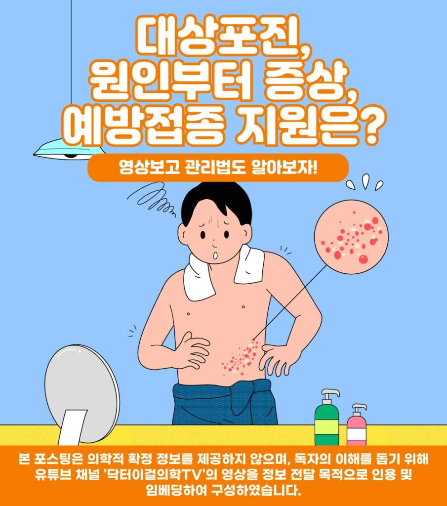 대상포진의 정보를 전달하기위한 포스팅의 대표이미지