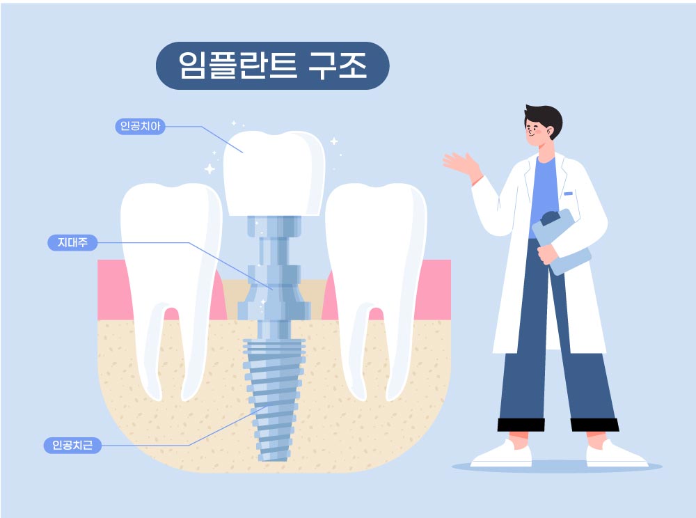 임플란트의 구조